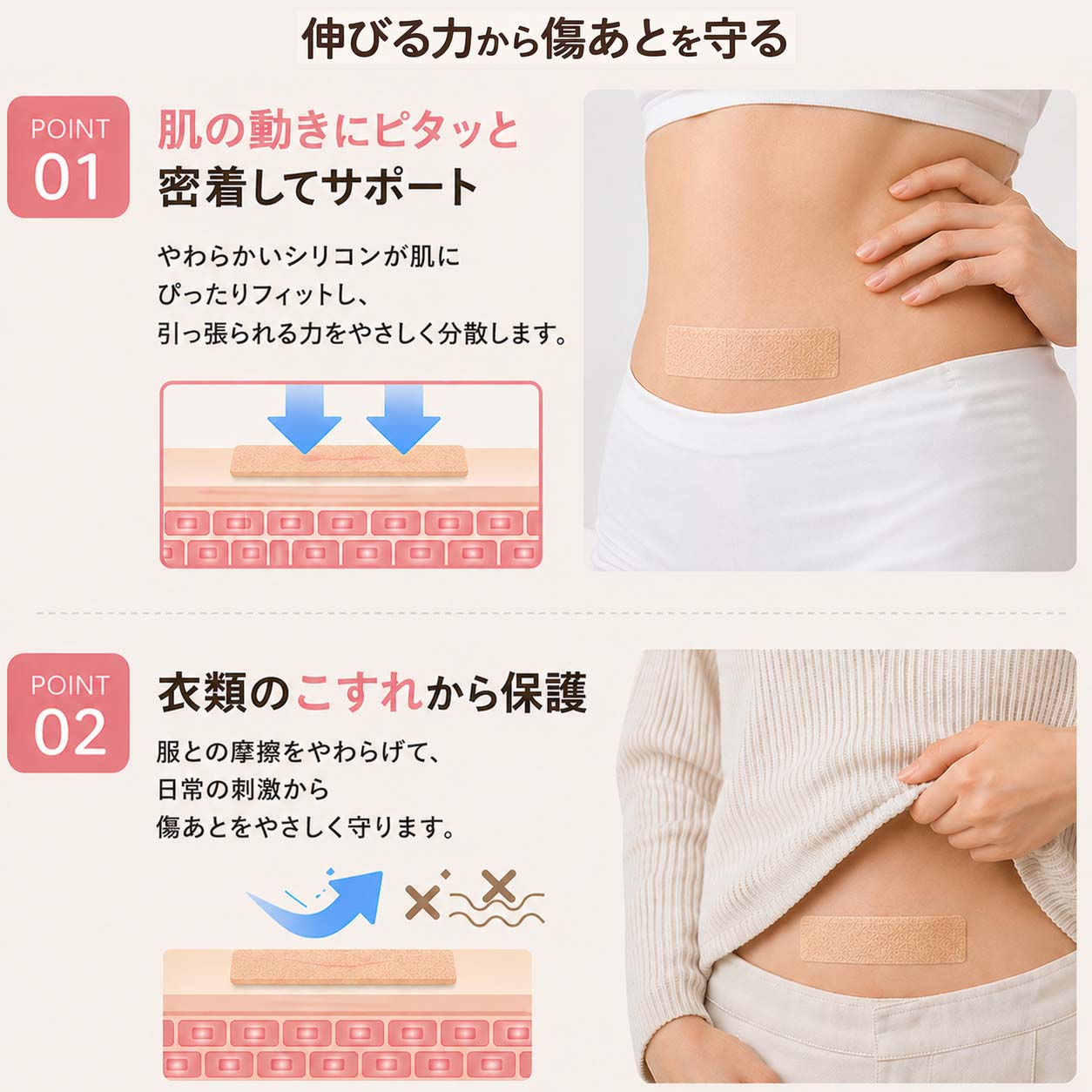 Nopra（ノプラ） 傷あとケアテープ 1.5m 3m 帝王切開 傷跡テープ 手術後 手術 傷テープ キズアト 傷跡ケロイド シリコンテープ 紫外線カット 手術跡ケア 傷あとを目立たなくする 傷跡 隠し 傷あとテープ シリコン テープ メイク マミエル - Nopra（ノプラ）公式 / 月経カップ・月経ディスク